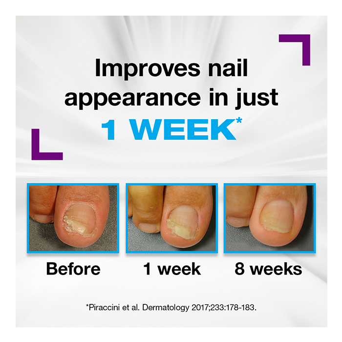 improves-nails-1-week